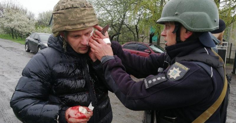 Під час затримання чоловіка в Дніпропетровській області стався вибух гранати, внаслідок чого постраждали п’ятеро правоохоронців. Дивіться наш фотозвіт.